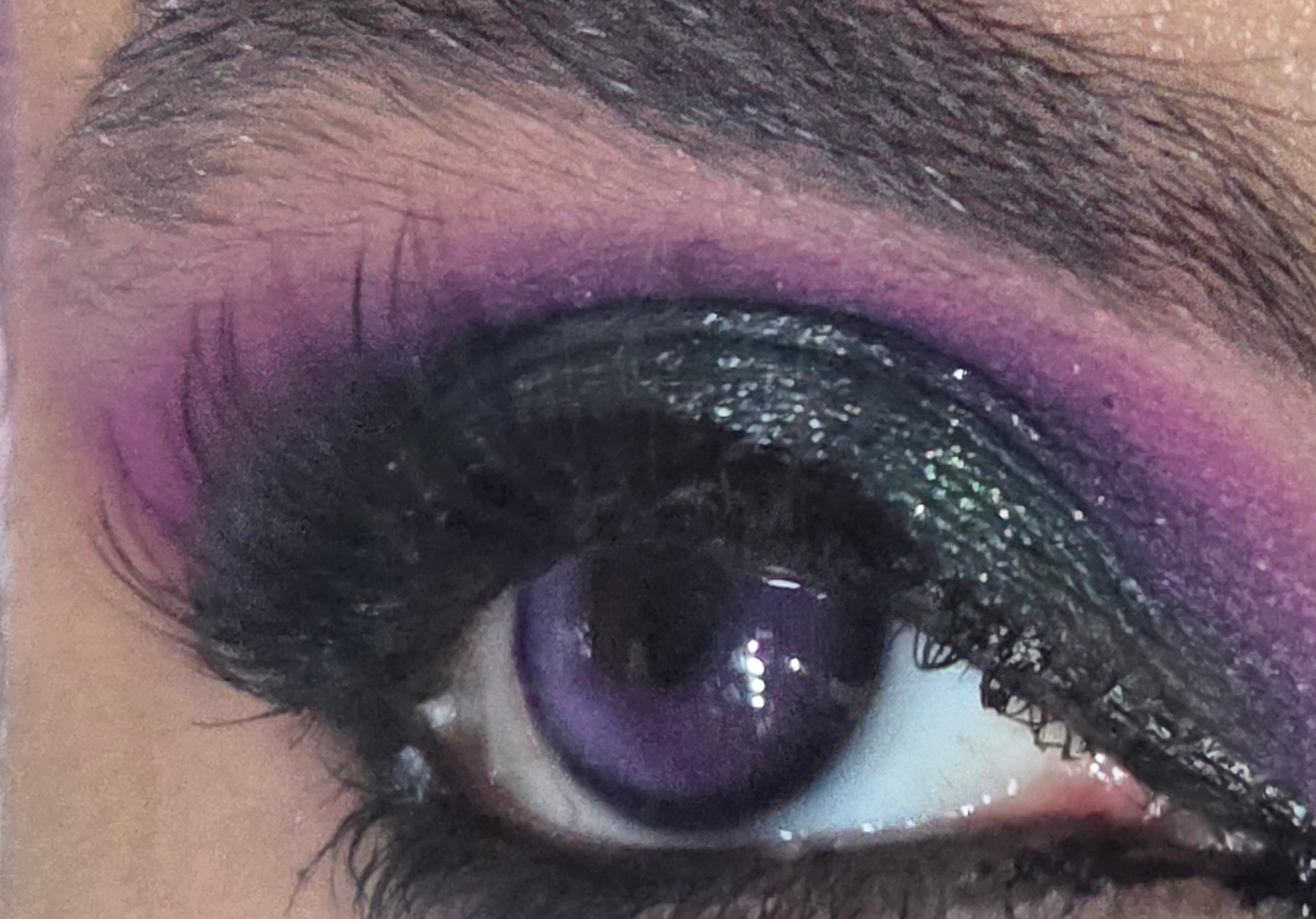 Contact Lenses